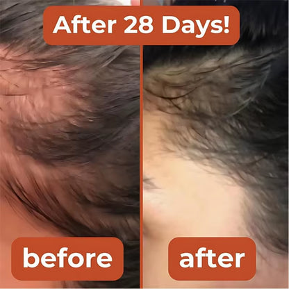 Pumpkin Seed Oil Soft Capsules 2 in 1 with Saw Palmetto Non-Gmo Natural Supplement Health Maintenance Regulation Blood Lipid